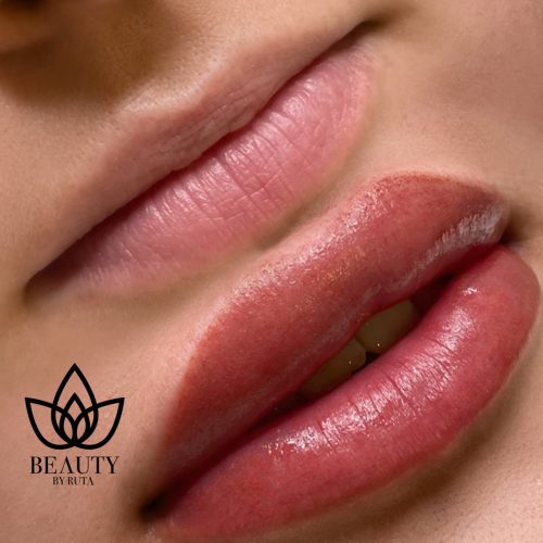 A5CF7081-1D29-44AF-83BD-F9CB5FEEA02B